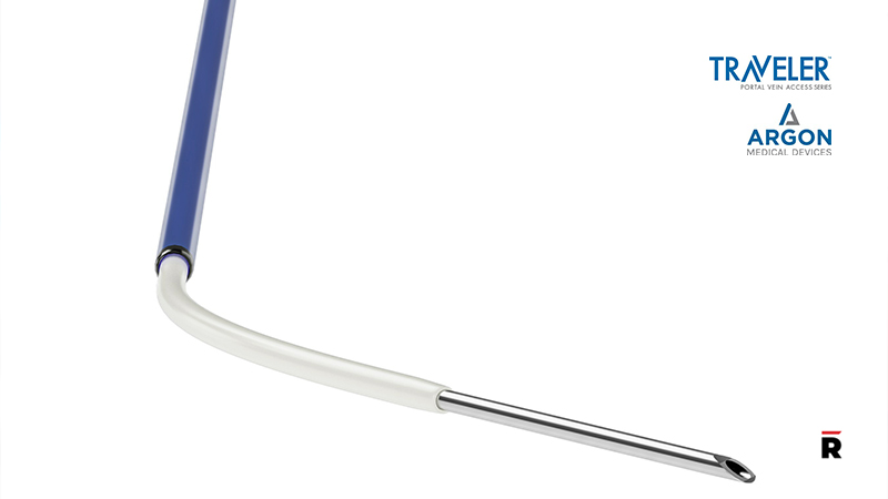 Argon Medical Devices Modernizes Portal Vein Access with the Launch of ...