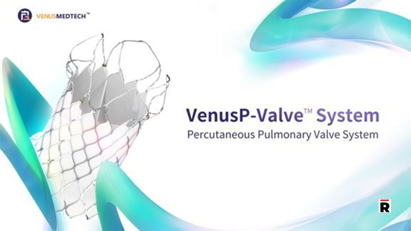 First American Patient Treated with VenusP-Valve™ Under Compassionate Use/Read magazine