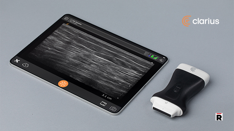 Florida Plastic Surgeons Using New Clarius Wireless Ultrasound to Comply with Emergency Order Mandating Ultrasound Guidance for Safer BBL Procedures/Read Magazine