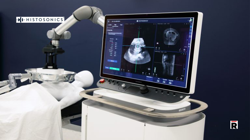 HistoSonics Hits Pivotal Clinical Trial Milestone In _HOPE4LIVER Studies/Read Magazine