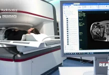 Medimaps Group and Radiobotics announce a strategic merger to expand AI musculoskeletal imaging analysis products Medimaps Group