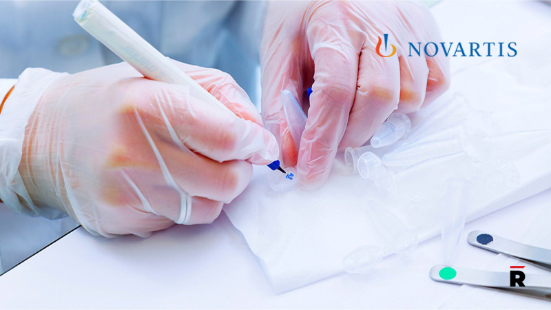 Novartis to acquire Gyroscope Therapeutics, adding a one-time gene therapy that could transform care for geographic atrophy, a leading cause of blindness logo/read magazine