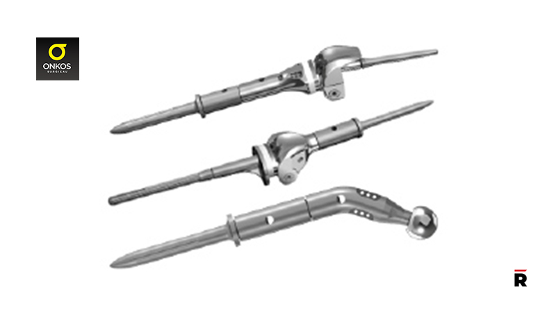 Onkos Surgical Announces Definitive Agreement to Acquire the JTS Extendible Prosthesis/Read Magazine