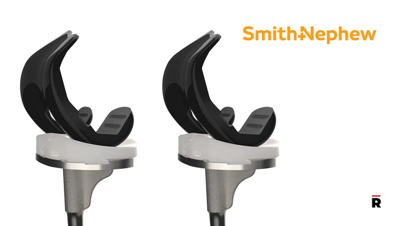 Smith+Nephew Announces First Surgery for Its Journey II Medial System